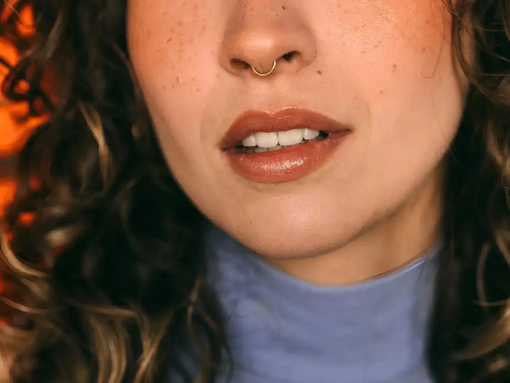 Hyaluron Nasolabialfalten-Unterspritzung - Pikodocs-Plattform